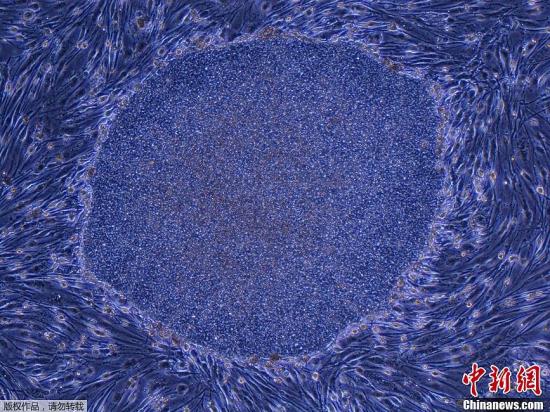 当地时间10月9日，日本东京京都大学iPS细胞研究和应用中心公布了来源于成年人类皮肤成纤维细胞的诱导多能干细胞。2012年10月8日，山中伸弥和剑桥大学的约翰·戈登教授因创造干细胞的工作获得2012诺贝尔医学奖。图为京都大学iPS细胞研究和应用中心公布的成年人类皮肤成纤维细胞的诱导多能干细胞照片。