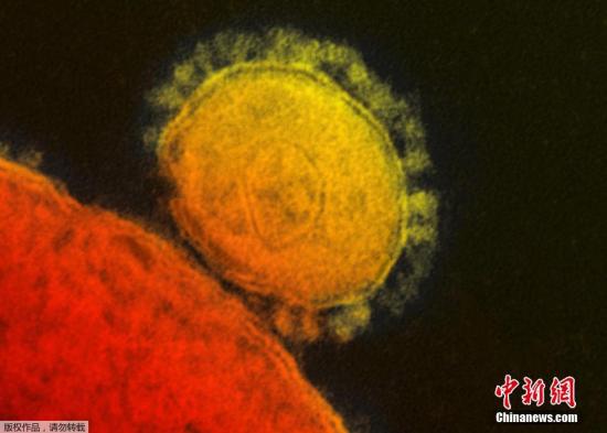 图为2014年5月2日，美国疾病控制中心公布的中东呼吸综合征冠状病毒（MERS）图像。