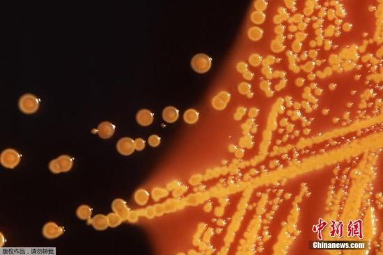 据外媒报道，美国卫生官员26日报告称，美国发现首例对所有已知抗生素有抵抗力的细菌感染病例，如果这种超级细菌传播，可能造成日常感染的严重危险。这种超级细菌自身首先是被名为质粒(plasmid)的小DNA分子感染，质粒携带可对粘杆菌素产生抗性的名为mcr-1的基因。而粘杆菌素是被专门用来对抗“噩梦细菌”的一种抗生素。图为显微镜下携带mcr-1基因的大肠杆菌。