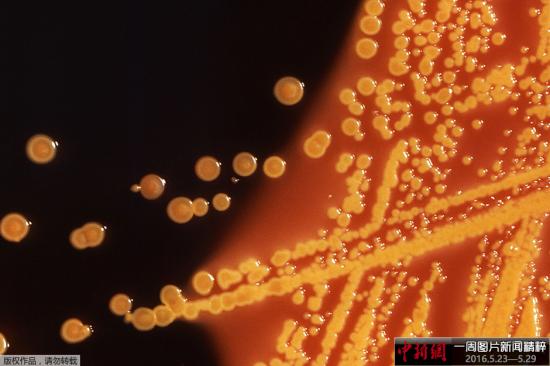 资料图：显微镜下携带mcr-1基因的大肠杆菌。