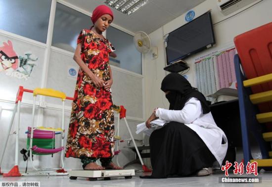 资料图：由于曾经长期处于营养不良状态，也门女子赛伊达身形比正常人要小不少。护士为赛伊达测量体重。
