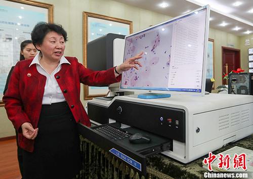 中国宫颈癌筛查技术获世卫组织资格认证
