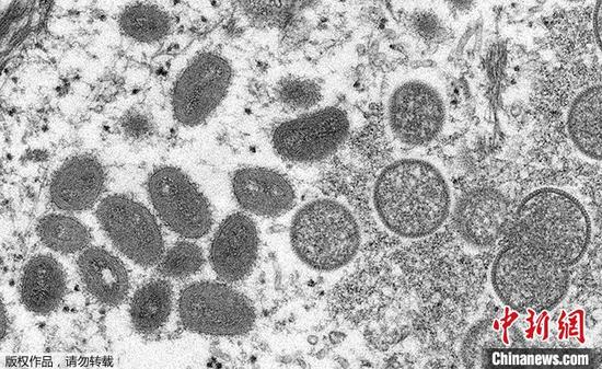 资料图为电子显微镜下成熟期的椭圆形猴痘病毒颗粒及新月形和球形的未成熟病毒颗粒。
