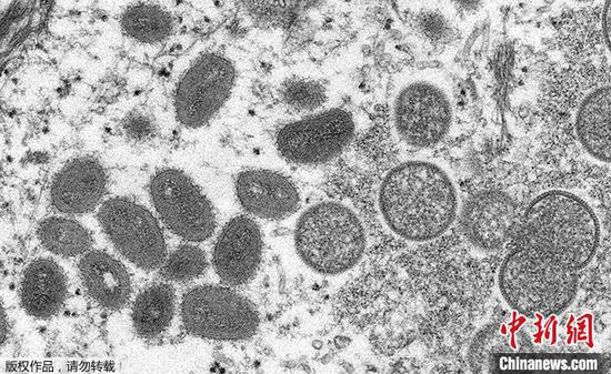 資料圖為電子顯微鏡下成熟期的橢圓形猴痘病毒顆粒及新月形和球形的未成熟病毒顆粒。