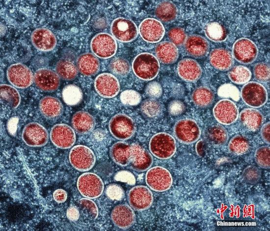 The monkeypox cells that were found in a U.S. lab. (Photo/Agencies)