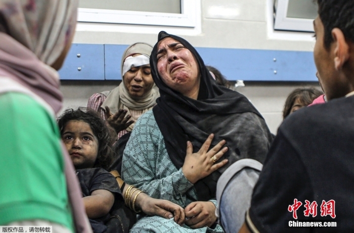 当地时间10月17日，以色列对加沙城发动空袭后，al-shifa医院里受伤的巴勒斯坦人。