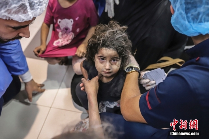 当地时间10月17日，加沙城，以色列炮击加沙城的ahli arab医院后，一名巴勒斯坦女孩在al-shifa医院接受治疗。据加沙卫生部门称，以色列对收容数千名难民的ahli arab医院发动空袭，造成数百人死亡和受伤。据报道，巴勒斯坦卫生部长发表声明称，以军袭击该医院已造成数百名平民死亡，其中遇难者多数是患者、妇女和儿童。图/视觉中国