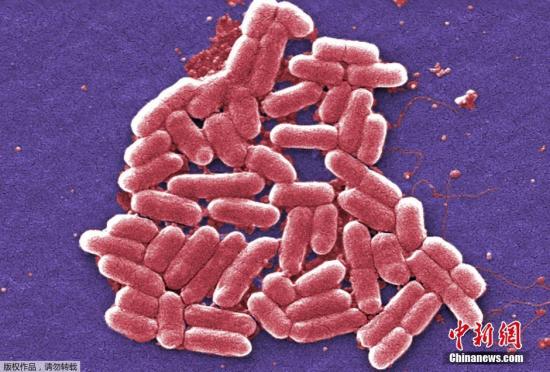 资料图：美国发现“超级细菌” 可抵抗所有已知抗生素 