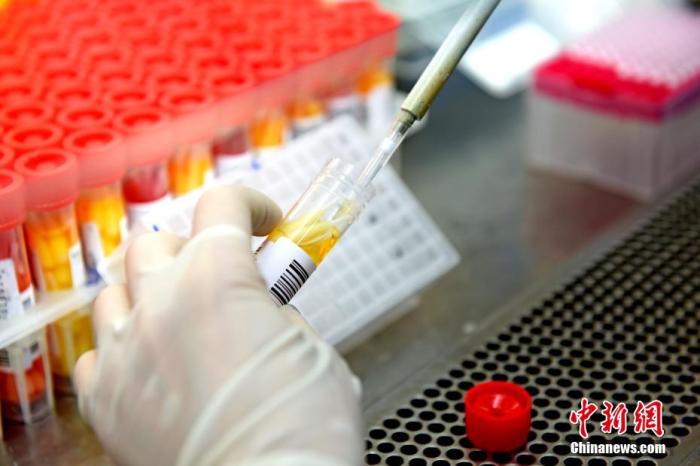 安徽理工大学第一附属医院PCR实验室内，检验人员在生物安全柜里将待检样本加入核酸提取试剂盒。 陈彬 摄